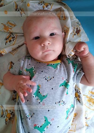 3-месячному малышу из Костромы срочно требуется помощь неравнодушных