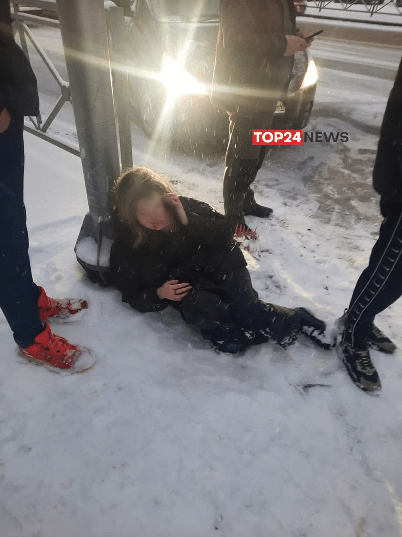В Костроме на пешеходном переходе сбили еще одну девушку