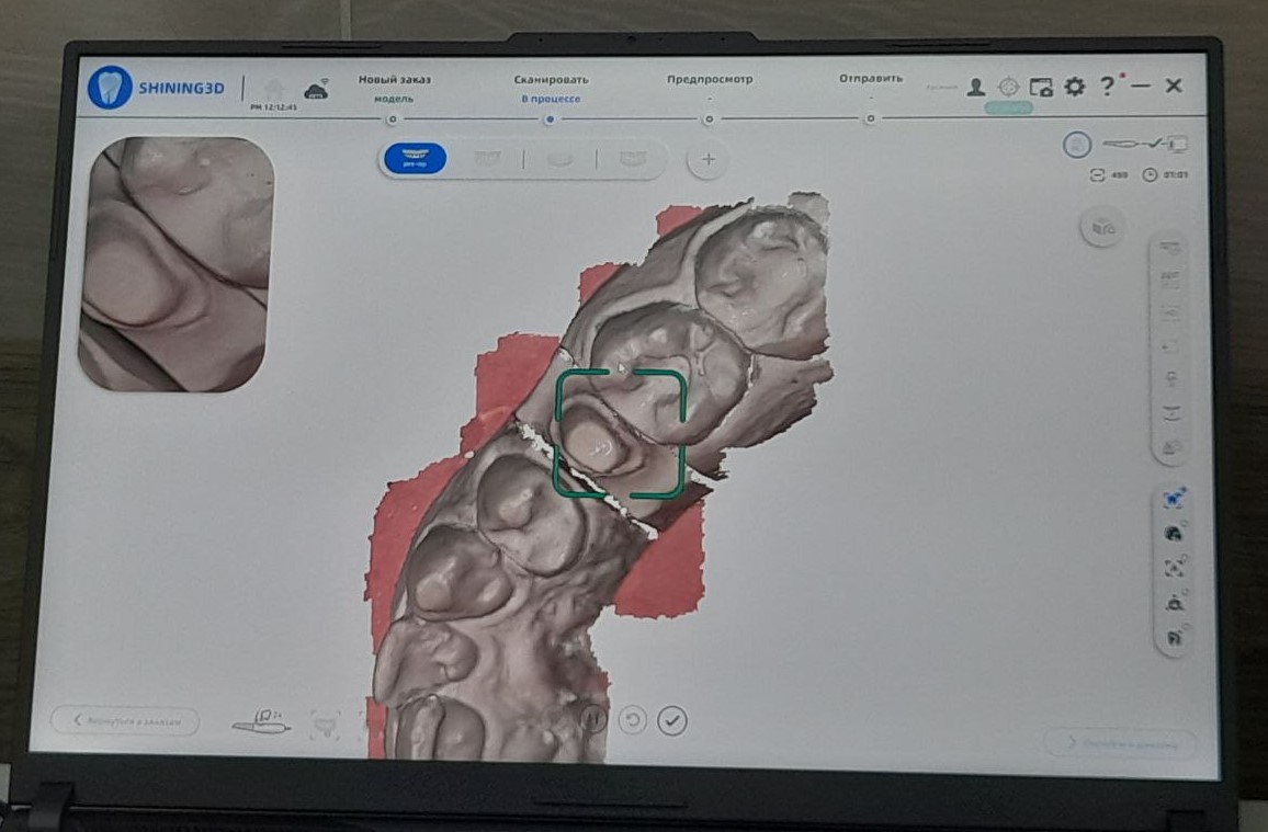 В костромской стоматологии произошла 3D-революция