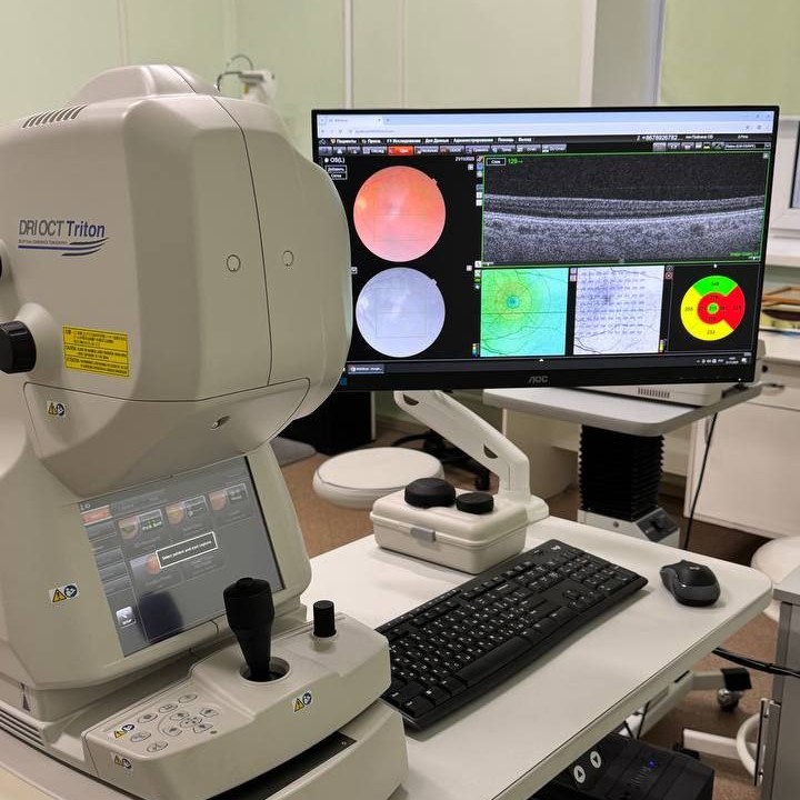 В Костромской областной больнице появился томограф для высокоточной диагностики глазных заболеваний