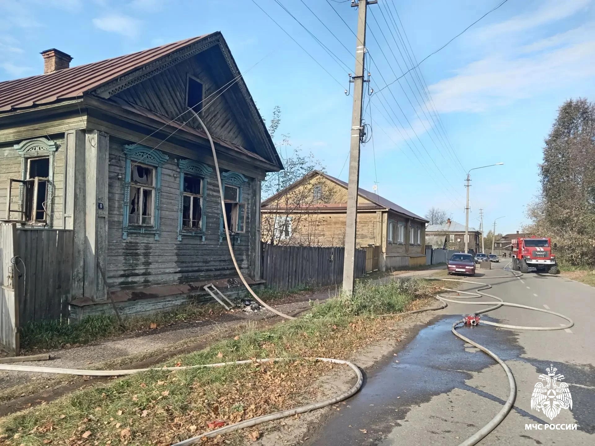 Пожилой костромич получил страшные ожоги головы при пожаре в частном доме